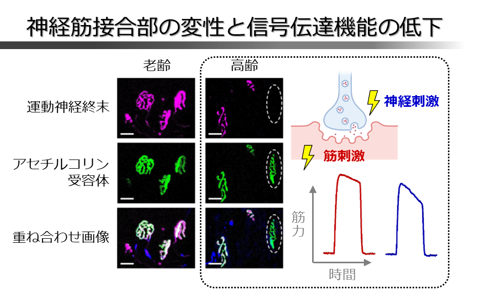 骨格筋の質の研究